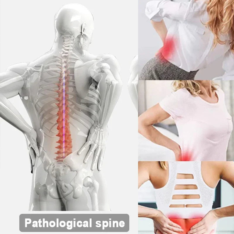 Illustration of painful spine and women with lower back pain, highlighting spinal discomfort.